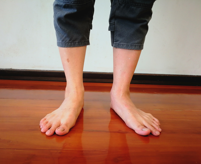 CGA Misaligned Feet